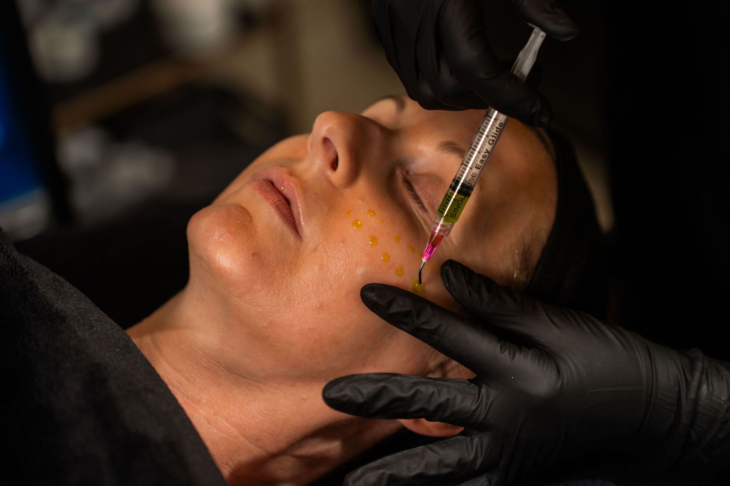 A provider applying a chemical peel to a client's face